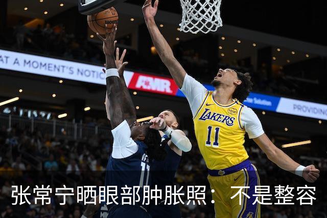 张常宁晒眼部肿胀照：不是整容
